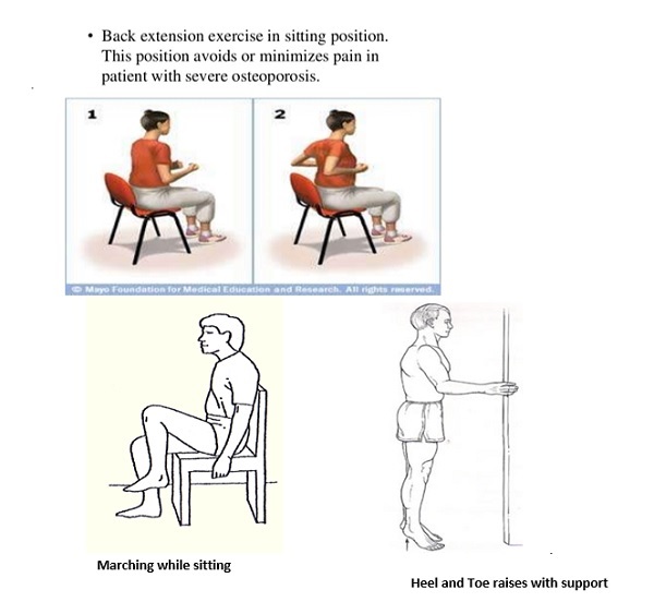 The Right Exercise For OsteoporosisPatientsEngage